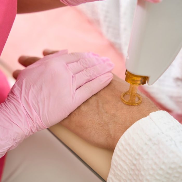 Lasr-Hair-Removal-in-London-UK-13-Medio.jpg